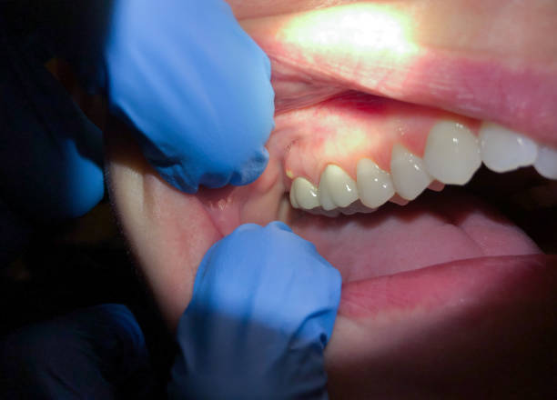 Best Tooth Infection Emergency Dentist  in Northport, NY